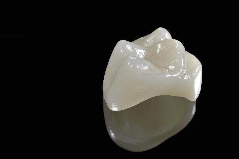 Porcelain Crowns Anaheim, CA